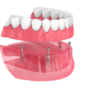 Dr Gabriel Jaramillo in Pompano Beach Florida